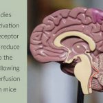 Activation of the cannabinoid receptor type 2 reduce damages to the brain and disruptions to the spinal cord during ischemia reperfusion injury