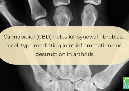 Cannabidiol CBD a killer for inflammatory rheumatoid arthritis synovial fibroblasts