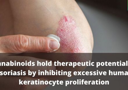 Cannabinoids inhibit human keratinocyte proliferation through a non CB1CB2 mechanism and have a potential therapeutic value in the treatment of psoriasis