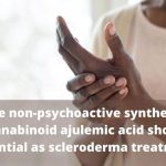 Synthetic cannabinoid Ajulemic acid exerts potent antifibrotic effects in experimental models of systemic sclerosis