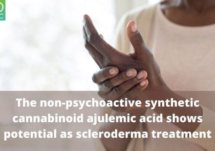 Synthetic cannabinoid Ajulemic acid exerts potent antifibrotic effects in experimental models of systemic sclerosis