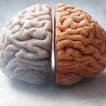 brain image