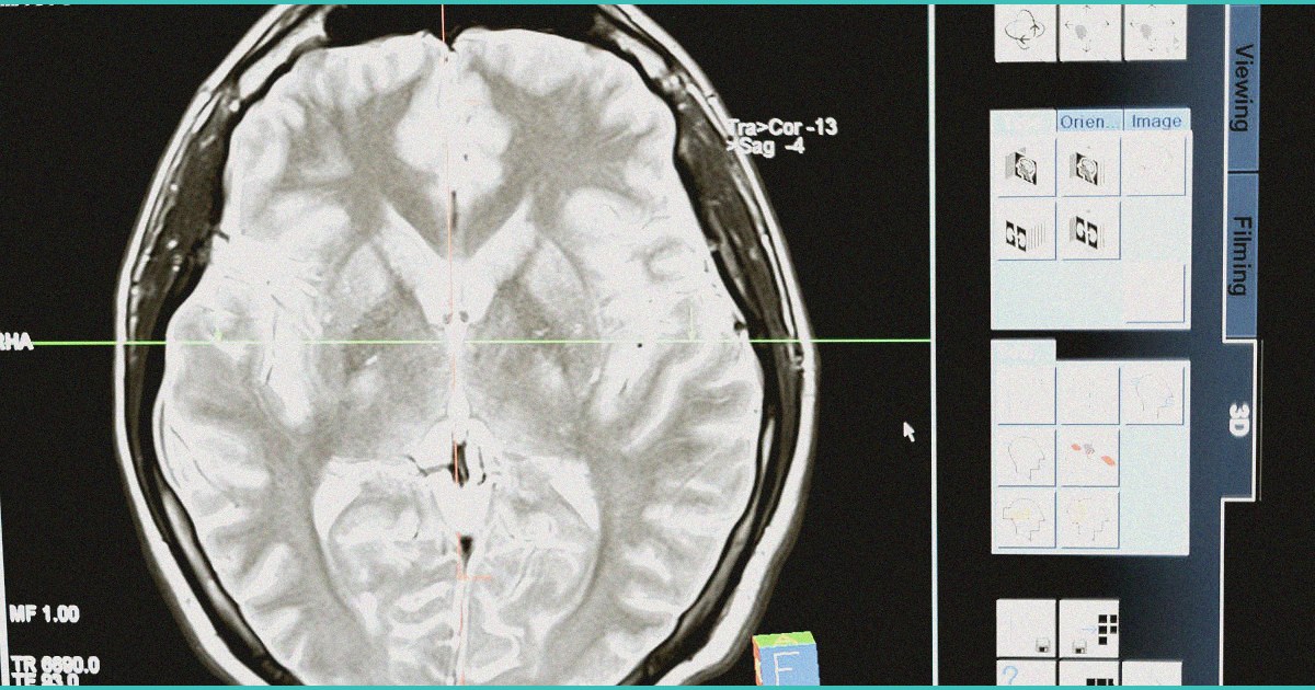 b study b finds no links between b cannabis b