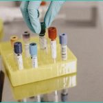 cannabis extracts significantly reduce myofascial