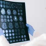 Endocannabinoid System & GLP-1 Mental Health Evidence
