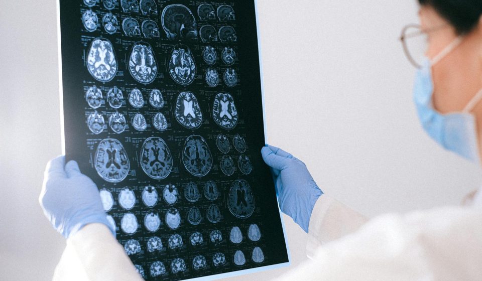 Endocannabinoid System & GLP-1 Mental Health Evidence