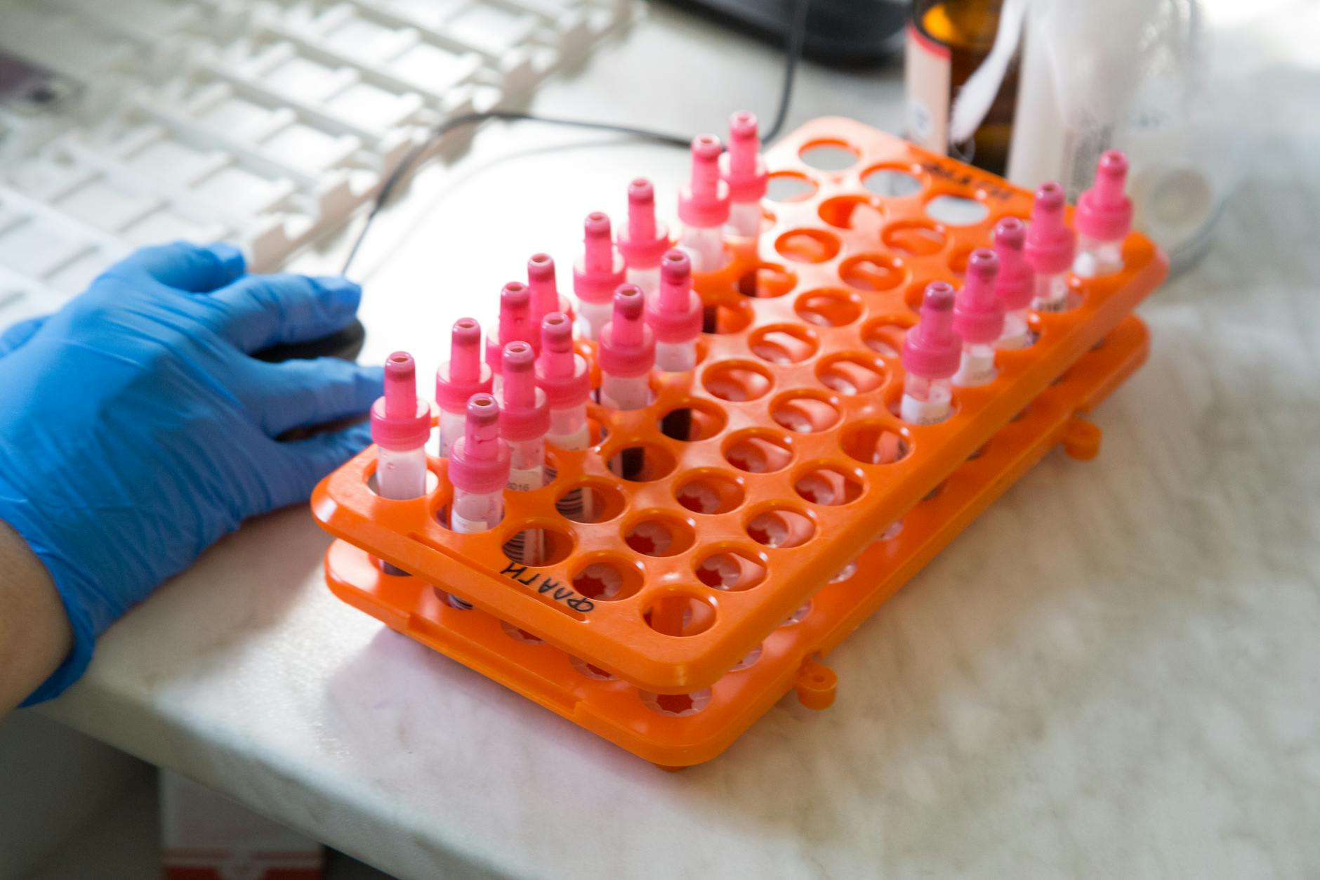 `Cannabidiol & Cortical Excitability: Clinical Trial Findings`