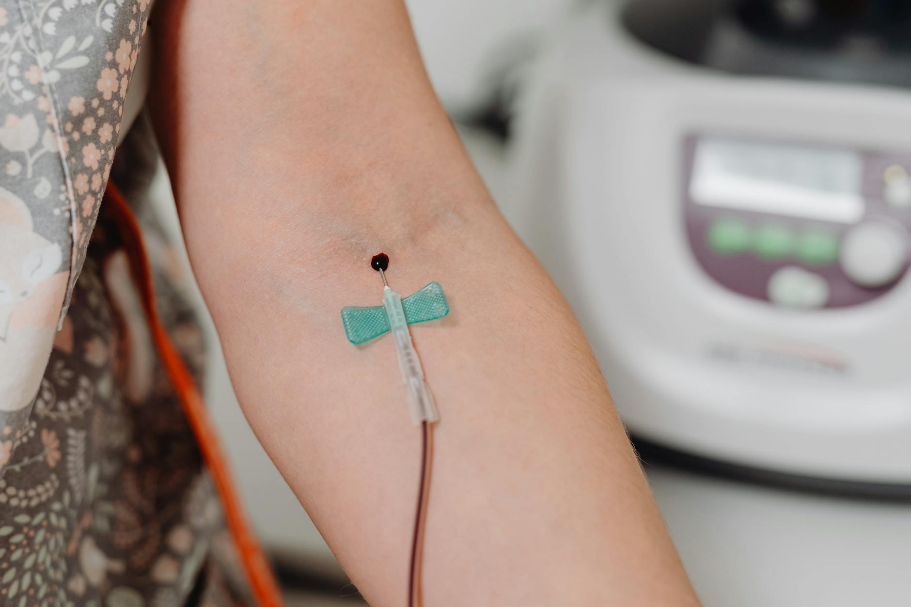 Study reveals cannabis compounds reduce threat of fatty liver disease | Health – WFMZ.com