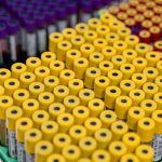 `Cannabinoid Clinical Trials: CBD, WADA, and Urine Testing`