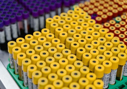 `Cannabinoid Clinical Trials: CBD, WADA, and Urine Testing`