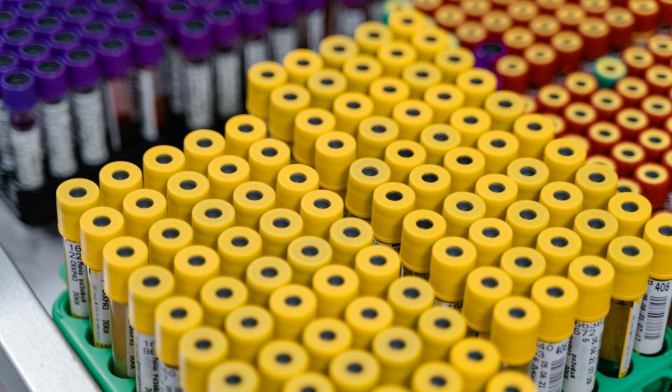 `Cannabinoid Clinical Trials: CBD, WADA, and Urine Testing`