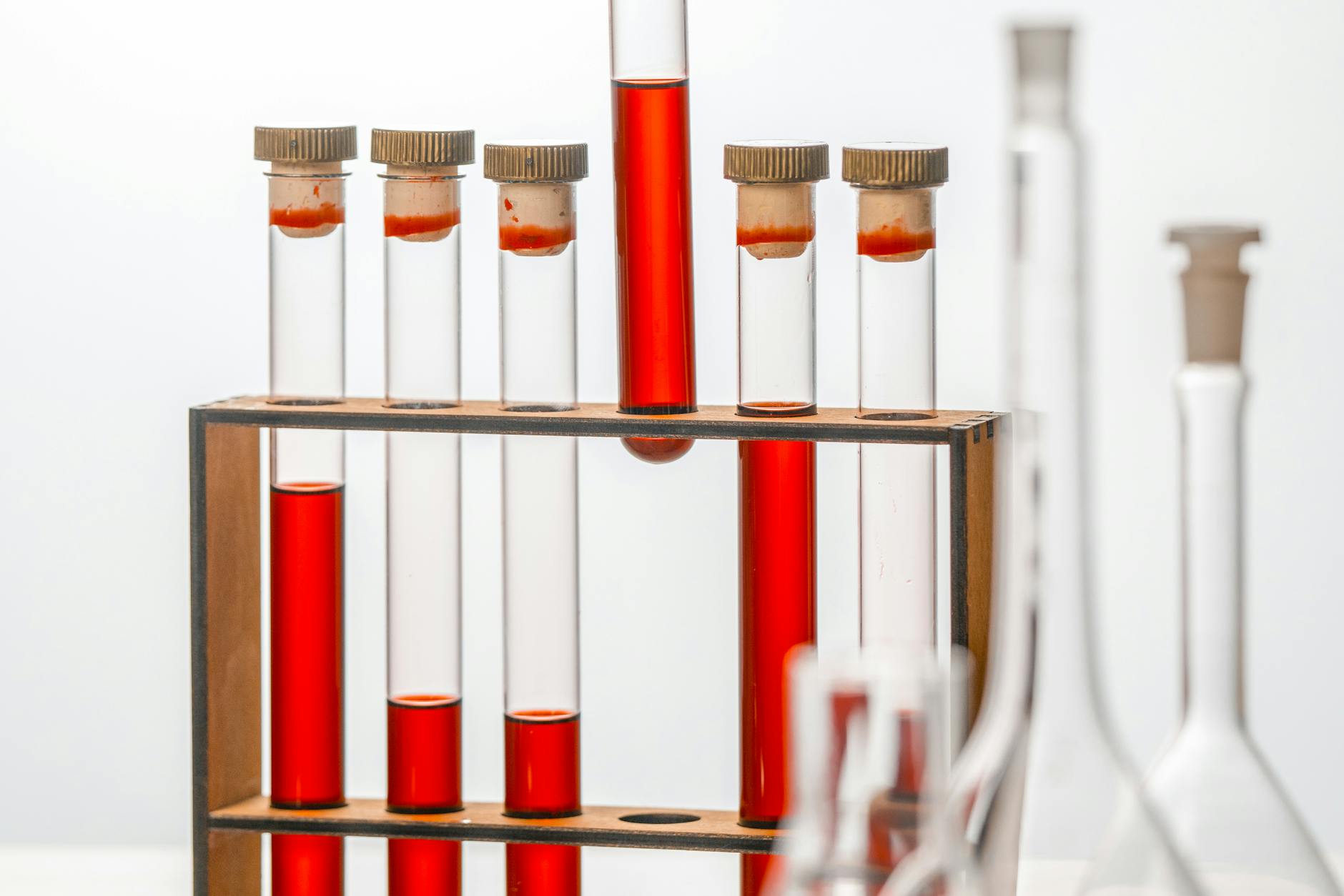 endocannabinoid system clinical research: Eating Disorders 2 endocannabinoid system clinical research: Eating Disorders