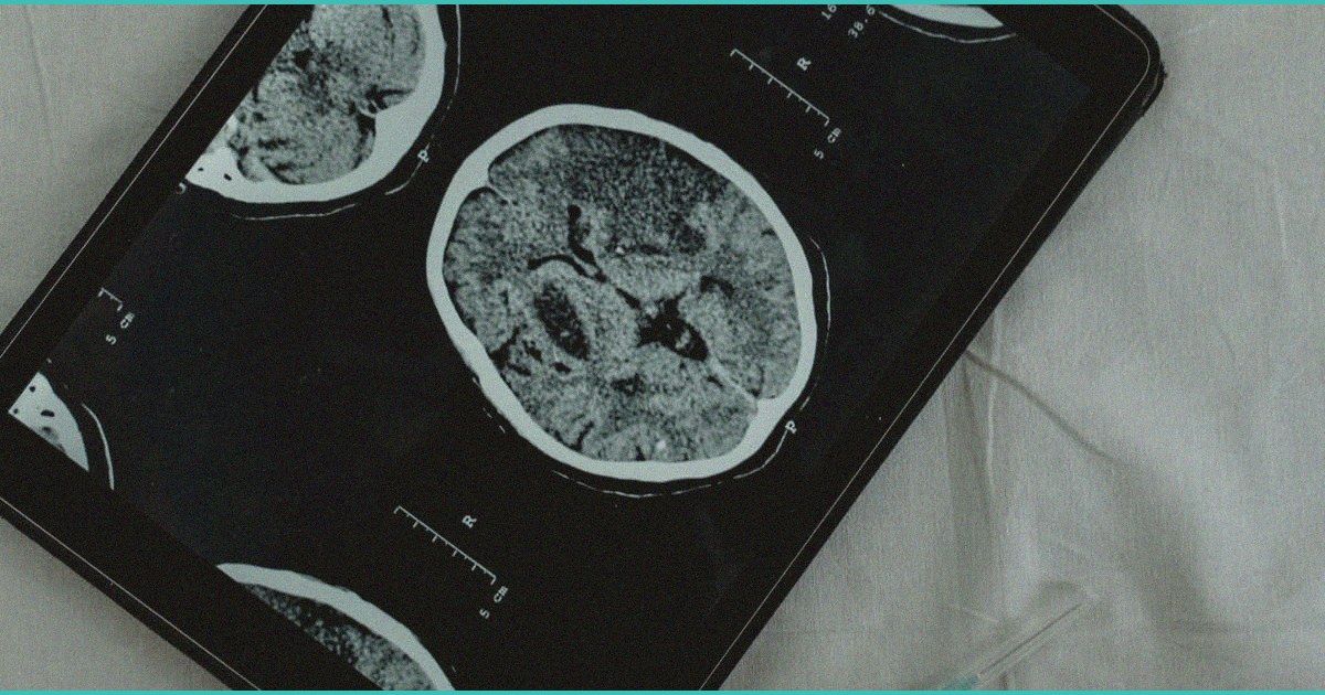 daily digest last 24 hours teen brain risk vete 1