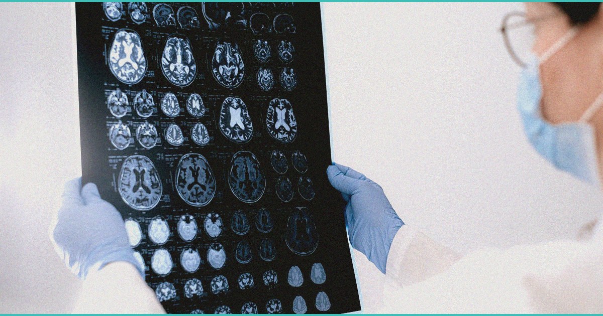 study finds no links between cannabis use and cogn 7