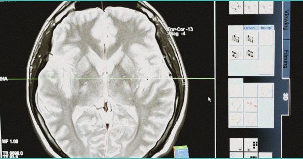 Study: Lifetime Cannabis Use Not Associated with Cognitive Decline or Dementia Risk in … – NORML
