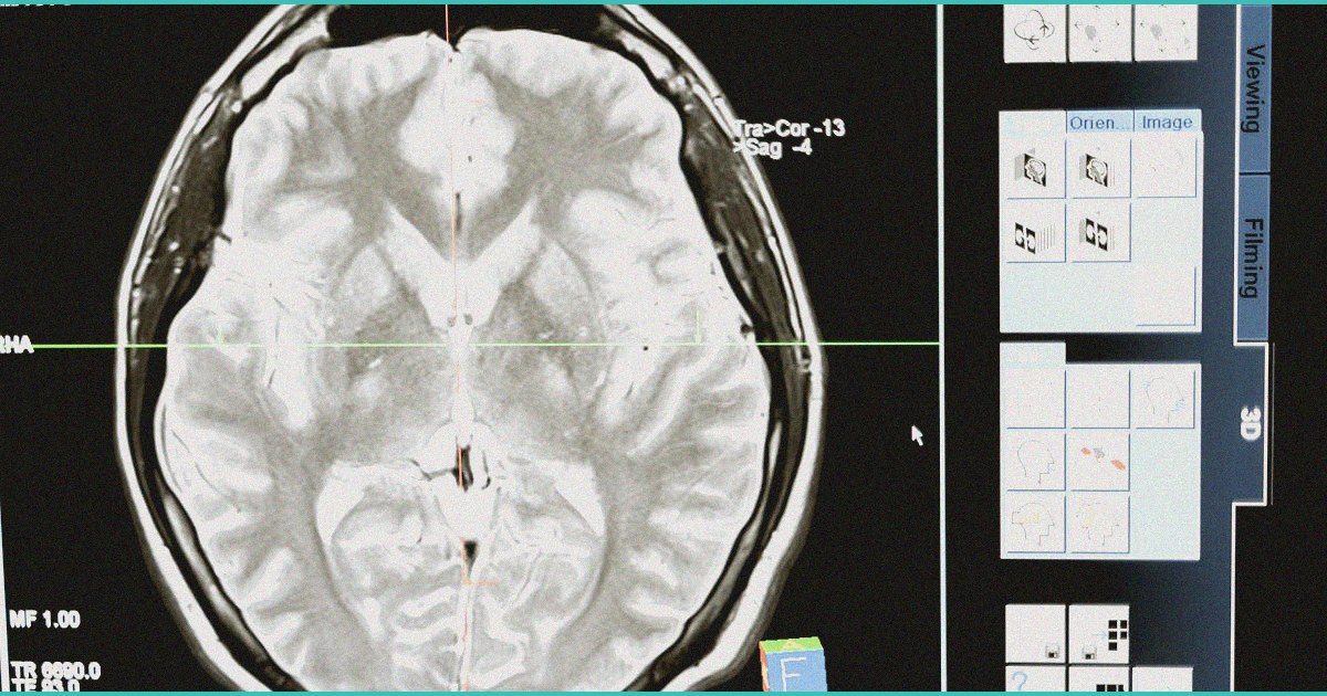 study lifetime cannabis use not associated with c 2