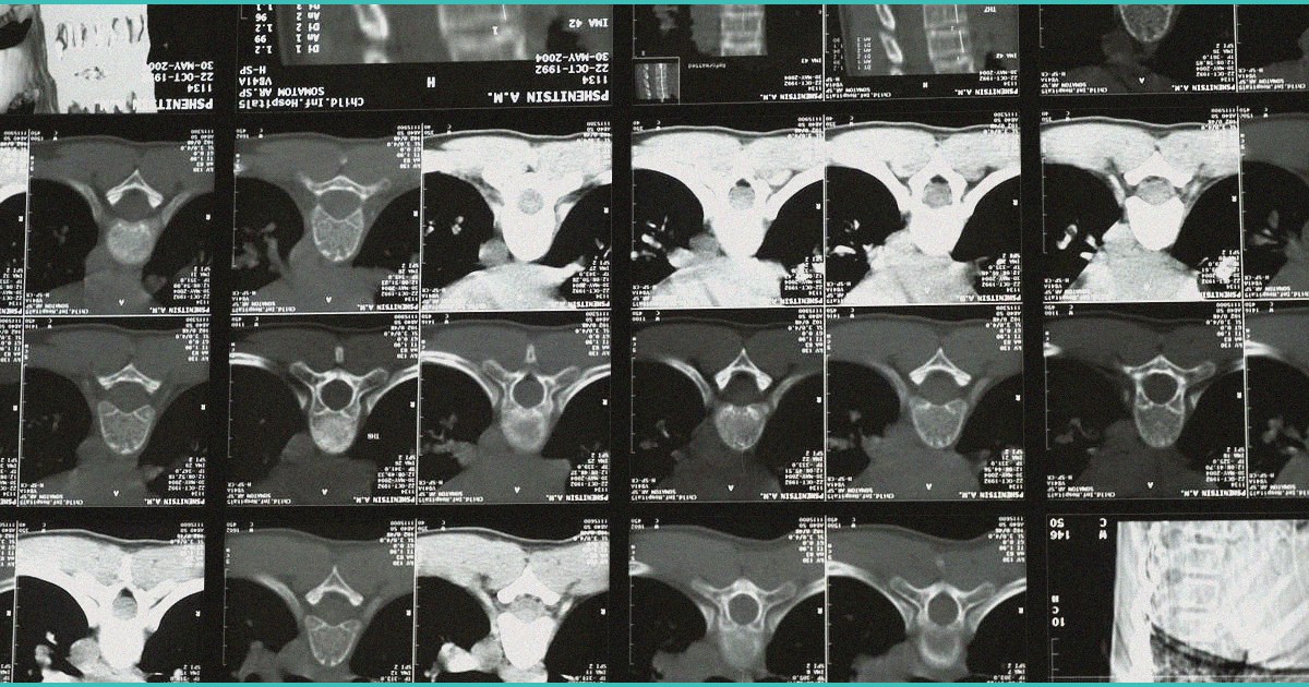 the cannabis mental health evidence gap associati 1