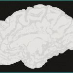 b cannabis b use associated with worse working