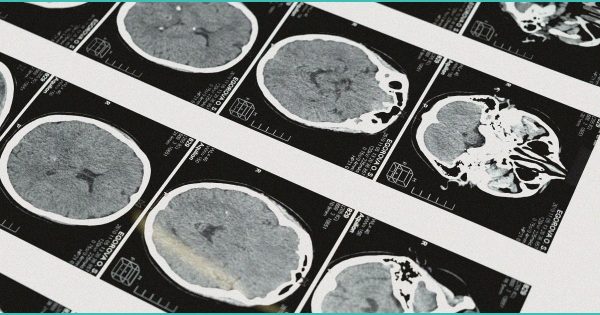 CED Clinic: Personalized Cannabis Medicine 204 Brain scans reveal how a woman voluntarily enters a psychedelic-like trance without drugs