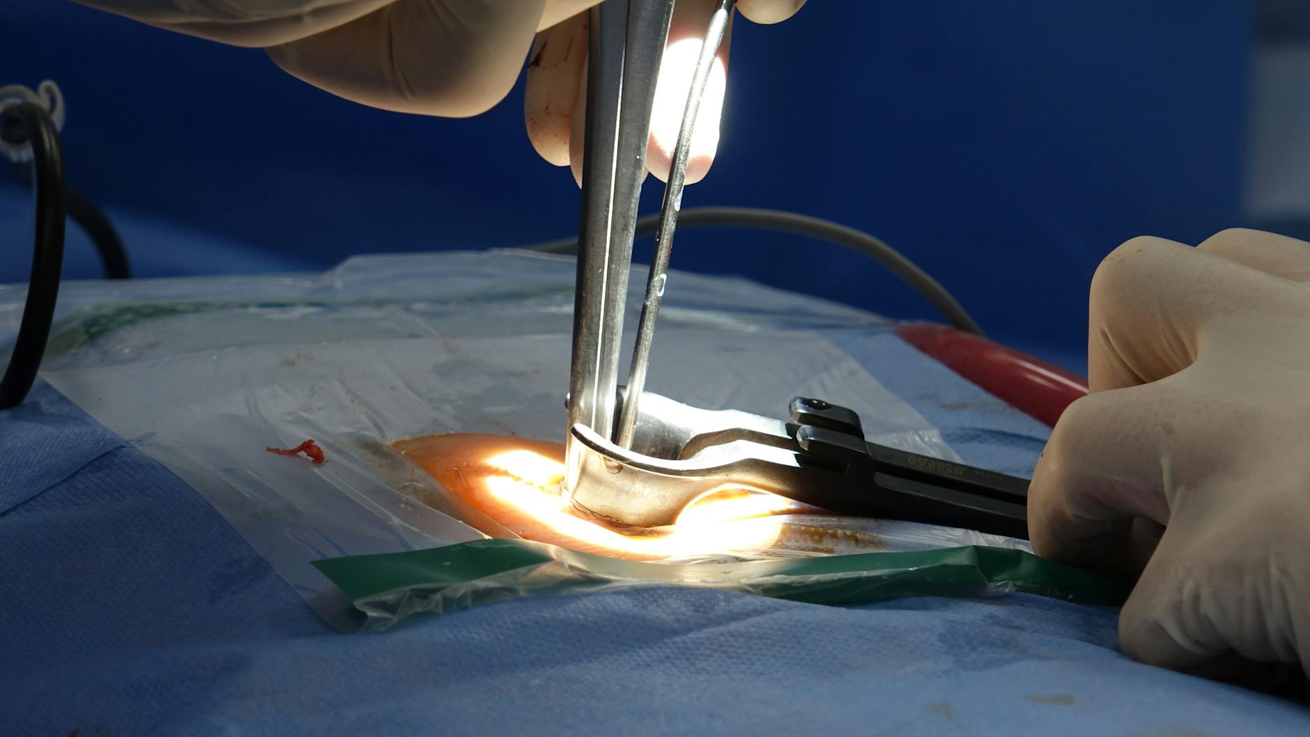 Endocannabinoid System in Trauma: Clinical Research Evidence