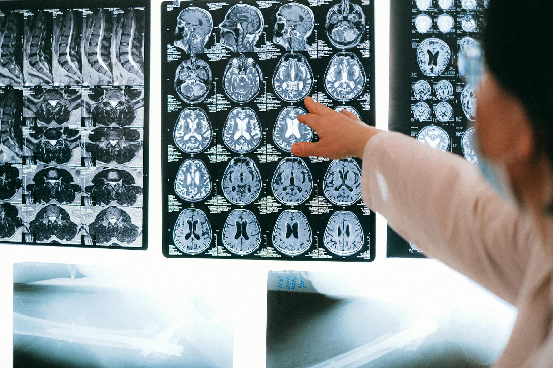 Endocannabinoid System & Psychosis Risk: Clinical Evidence 2 Endocannabinoid System & Psychosis Risk: Clinical Evidence
