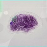 could cannabis help dementia patients with symptom