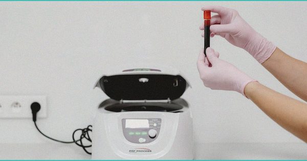 Full-Spectrum Cannabis Extract Shows Significant Pain Reduction in Chronic Neuropathic Pain