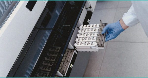 Marijuana Use Linked To Heart Attacks, Strokes In New Study – MSN