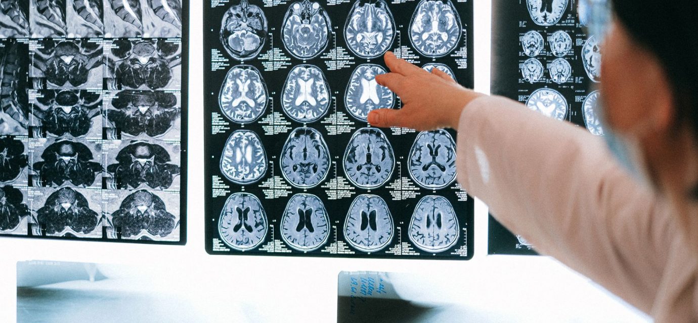 Assay: Irreversible inhibition of rat brain cytosolic MAGL assessed as [3H] - EMBL-EBI