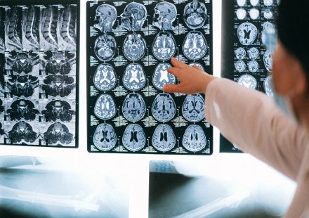 Assay: Irreversible inhibition of rat brain cytosolic MAGL assessed as [3H] - EMBL-EBI