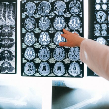 Assay: Irreversible inhibition of rat brain cytosolic MAGL assessed as [3H] - EMBL-EBI