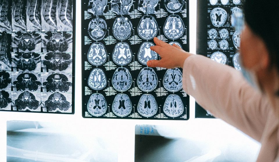Assay: Irreversible inhibition of rat brain cytosolic MAGL assessed as [3H] - EMBL-EBI