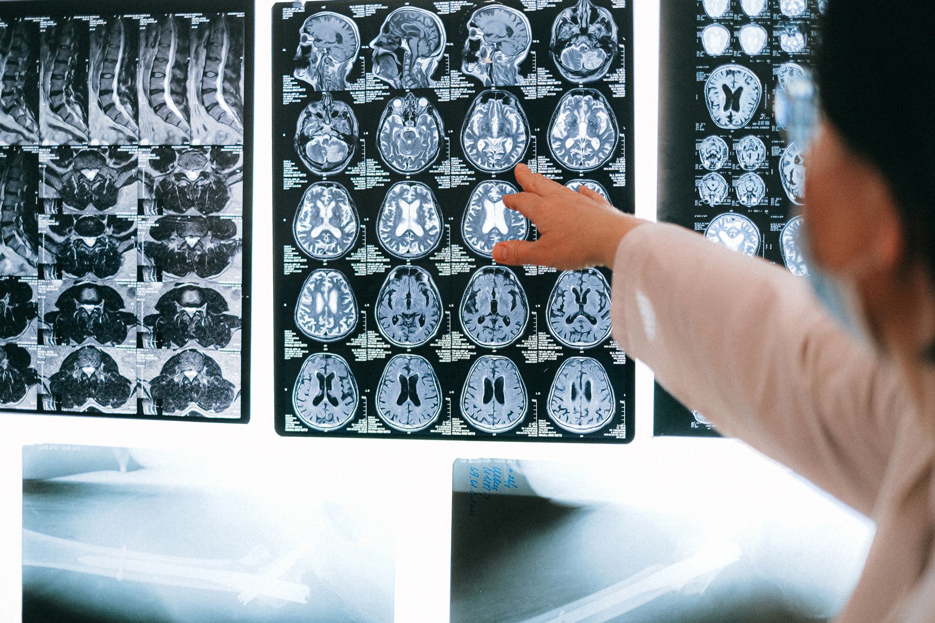 Assay: Irreversible inhibition of rat brain cytosolic MAGL assessed as [3H] – EMBL-EBI