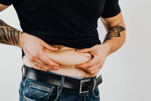 CED Clinic: Personalized Cannabis Medicine 253 Weight Loss Outcomes Between GLP-1 Receptor Agonists and Bariatric Surgery in Adults