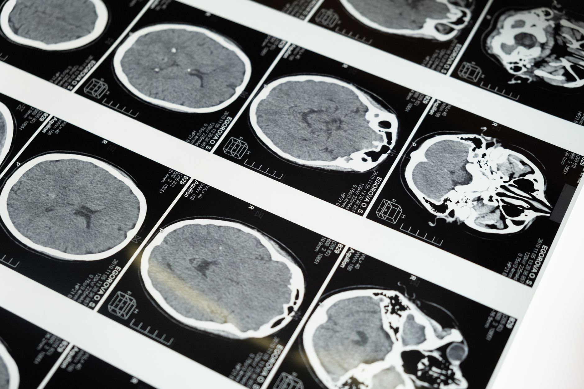 Brain scans reveal shocking difference between psychopaths and people without condition 32 Brain scans reveal shocking difference between psychopaths and people without condition