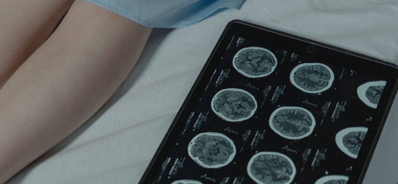 Brain scans reveal shocking difference between psychopaths and people without condition