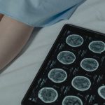 Brain scans reveal shocking difference between psychopaths and people without condition