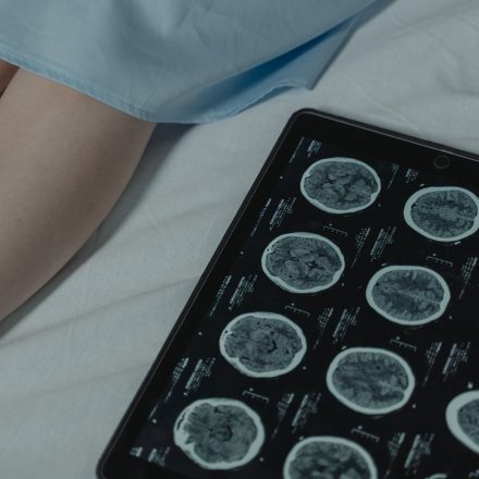Brain scans reveal shocking difference between psychopaths and people without condition