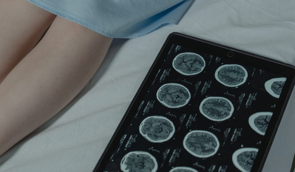 Brain scans reveal shocking difference between psychopaths and people without condition