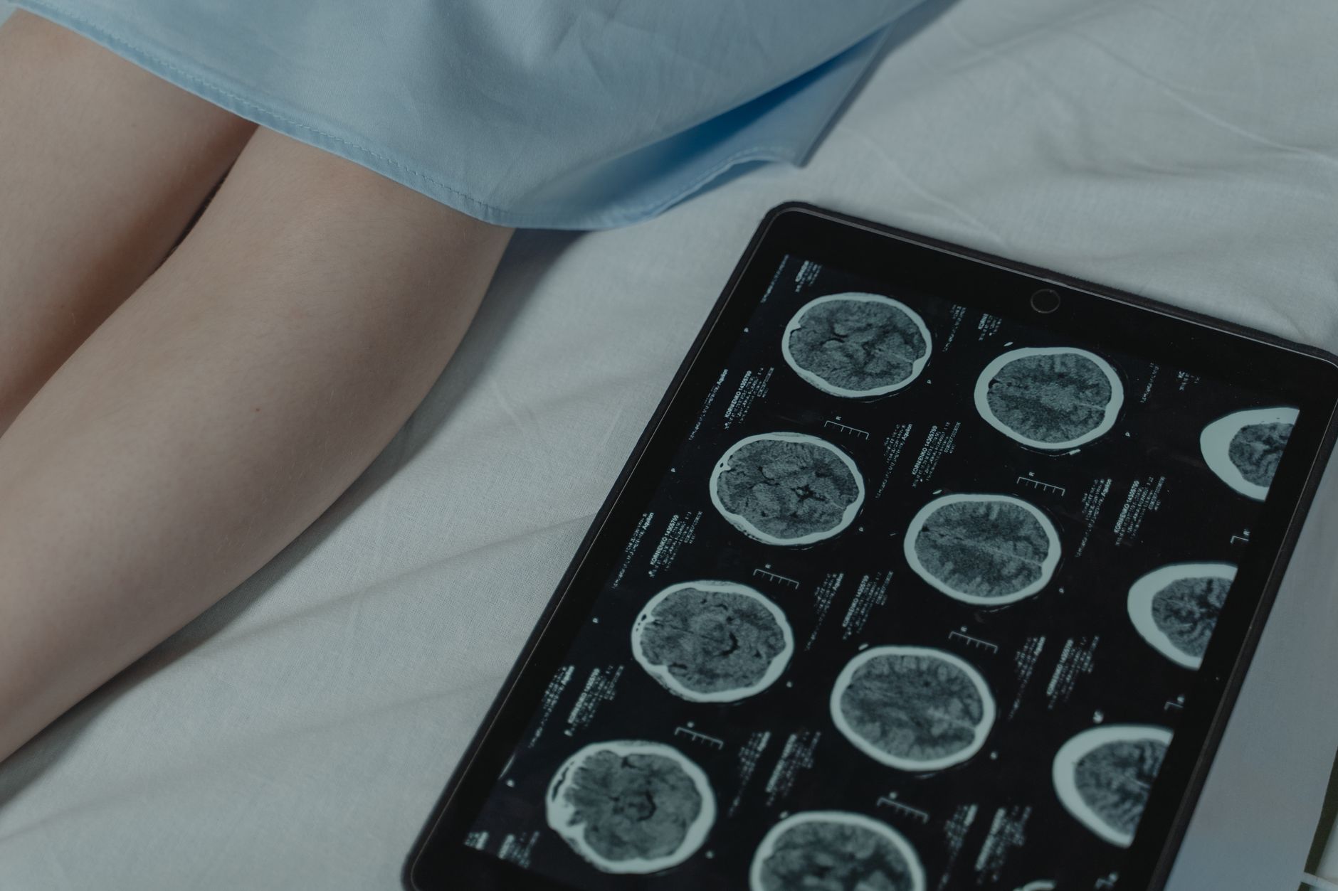 Brain scans reveal shocking difference between psychopaths and people without condition