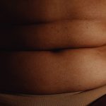 Can humans with obesity also benefit from cannabis? - The Physiological Society
