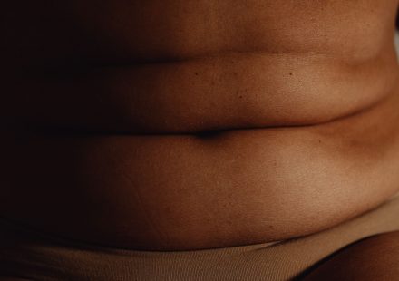 Can humans with obesity also benefit from cannabis? - The Physiological Society
