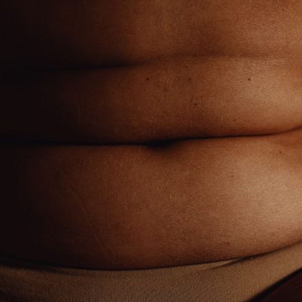 Can humans with obesity also benefit from cannabis? - The Physiological Society