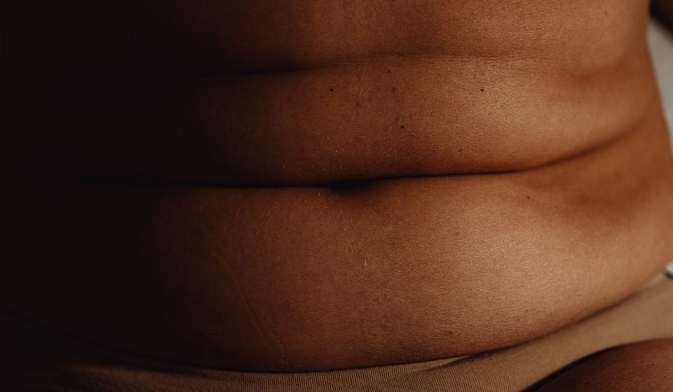 Can humans with obesity also benefit from cannabis? - The Physiological Society