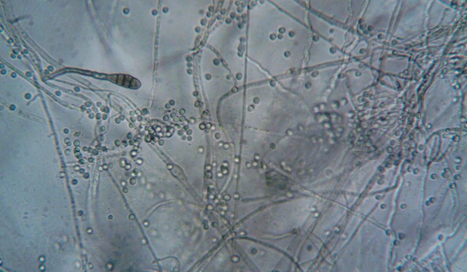 Maine recalls cannabis over unsafe mold and yeast levels