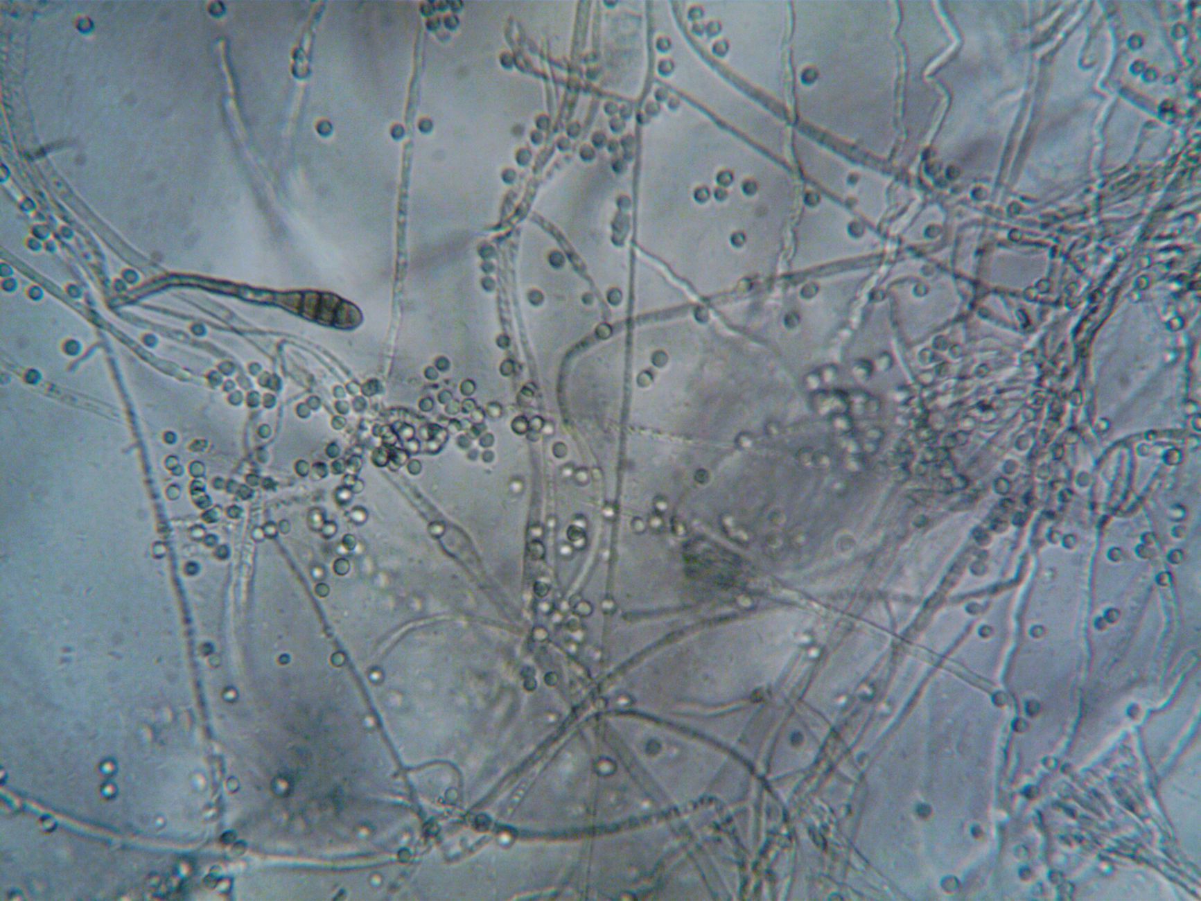Maine recalls cannabis over unsafe mold and yeast levels