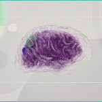 histamine brain pathways and psychiatric disorders
