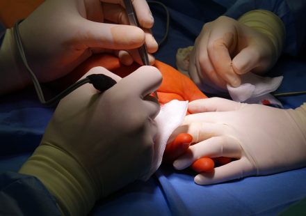 Clinical Trial: CBD Linked to Reduced Pain and Inflammation in Patients With Recurrent Pericarditis