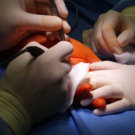 Clinical Trial: CBD Linked to Reduced Pain and Inflammation in Patients With Recurrent Pericarditis