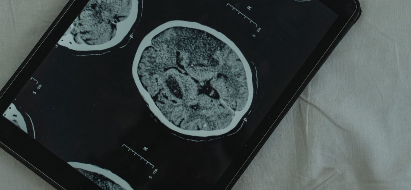 RECAP: Neurology News Network - Week of July 25th | NeurologyLive